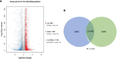 Abnormal Neutrophil Transcriptional Signature May Predict Newly Diagnosed Latent Autoimmune Diabetes in Adults of South China